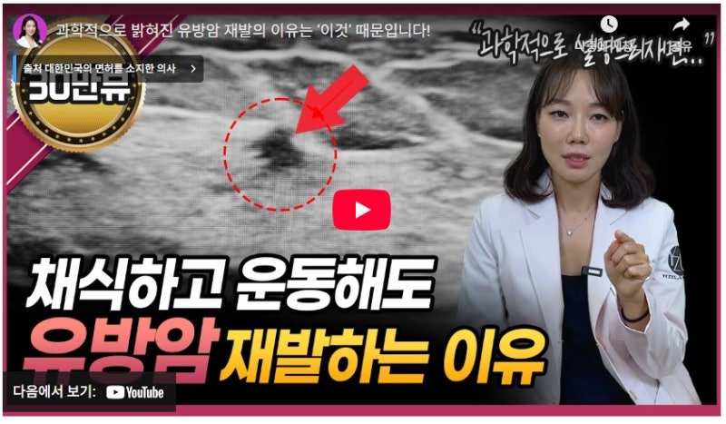 유방암 카페, 갑상선암 카페 정보 찾고 있다면? ‘유갑카페’에서