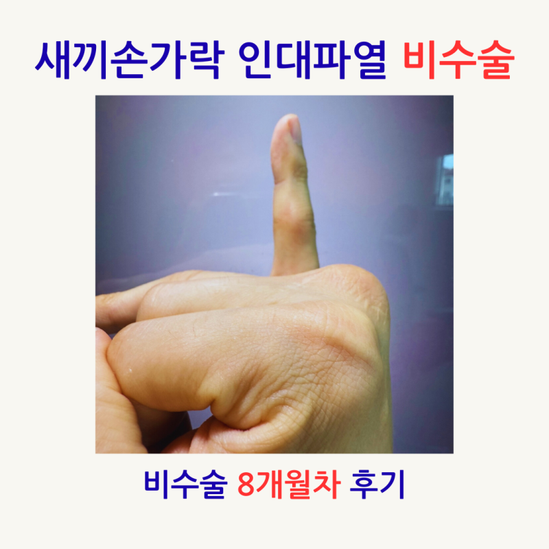 새끼손가락 인대파열 비수술 8개월차 자연치유 경과와 경험 공유