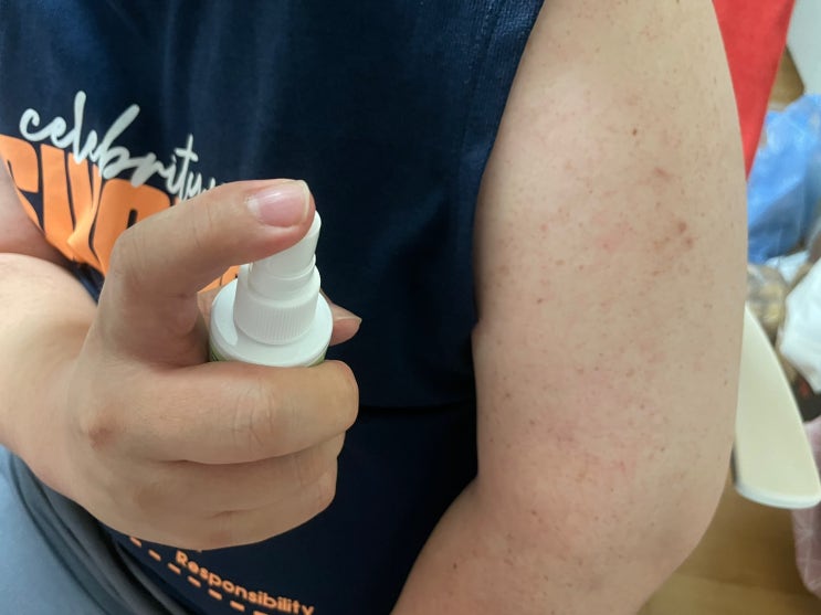  여름 필수템! '일양약품 모스오프 50ml' 모기기피제로 쾌적한 여름 나기!