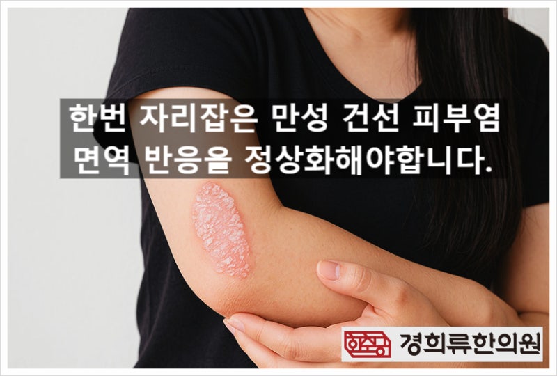 건선 피부염, 이렇게 치료하면 됩니다(한의사 칼럼)
