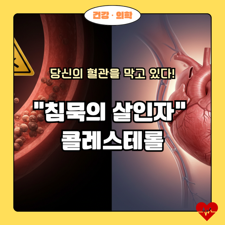  콜레스테롤 수치가 높아지면? 방치하면 생기는 일 4가지