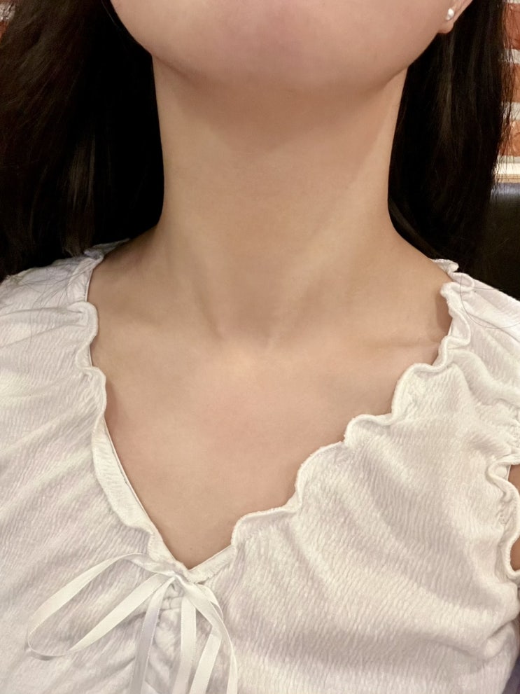  압구정 가로 목주름필러 방황하다 드디어 정착한 내돈내산 솔직후기 (통증, 2주후기)