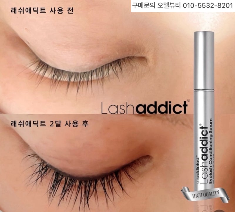 속눈썹 영양제 다 써보고 추천 "래쉬애딕트"(정품구매법+할인팁 공유)