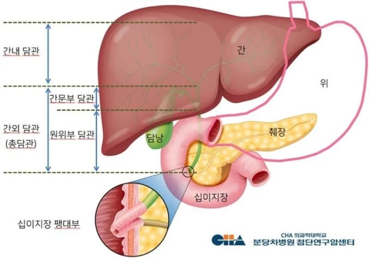 ‘진단 늦고 희망 짧다’던 담도암, 건강보험 개정으로 ‘새 빛’