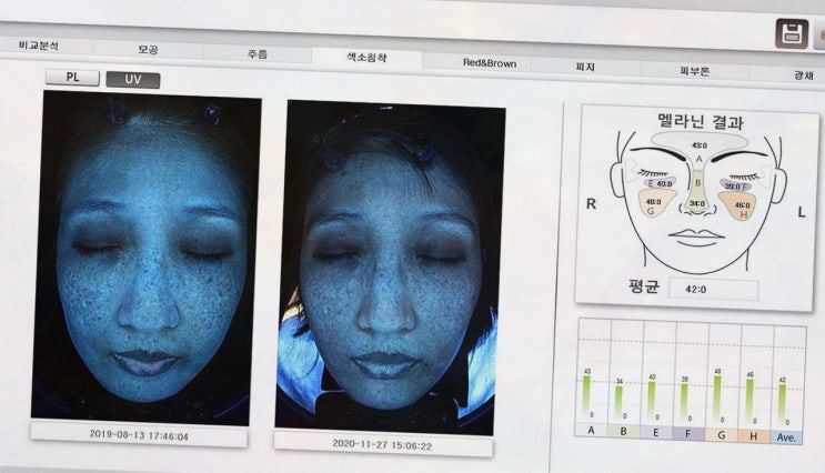  삐땅기린뷰티 센터에서 경험한 피부관리의 모든 것