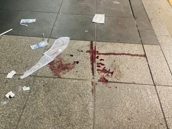 [속보] 서울 <b>길음역</b> 인근 충격 <b>칼부림</b> 사건! 대낮 <b>흉기 난동</b>에... 
