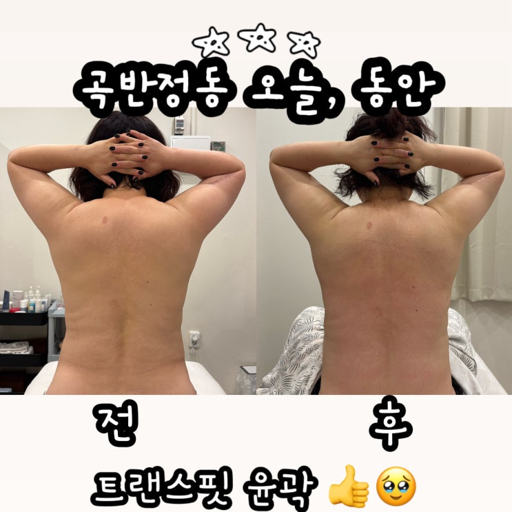  곡반정동 피부샵 오늘, 동안 피부 붓기 관리