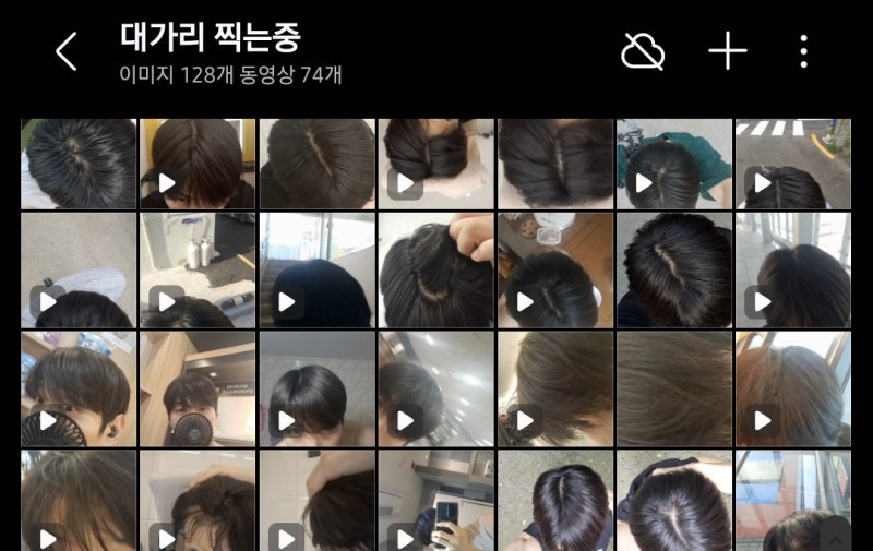 이소티논 때문에 탈모 왔었습니다.