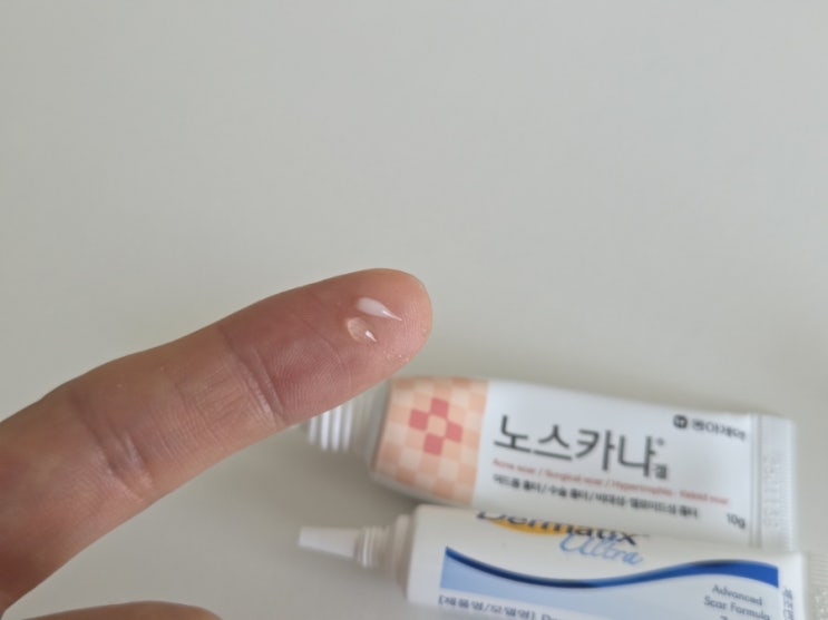  아이 수술 후, 매일 이 연고로 흉터 관리 중