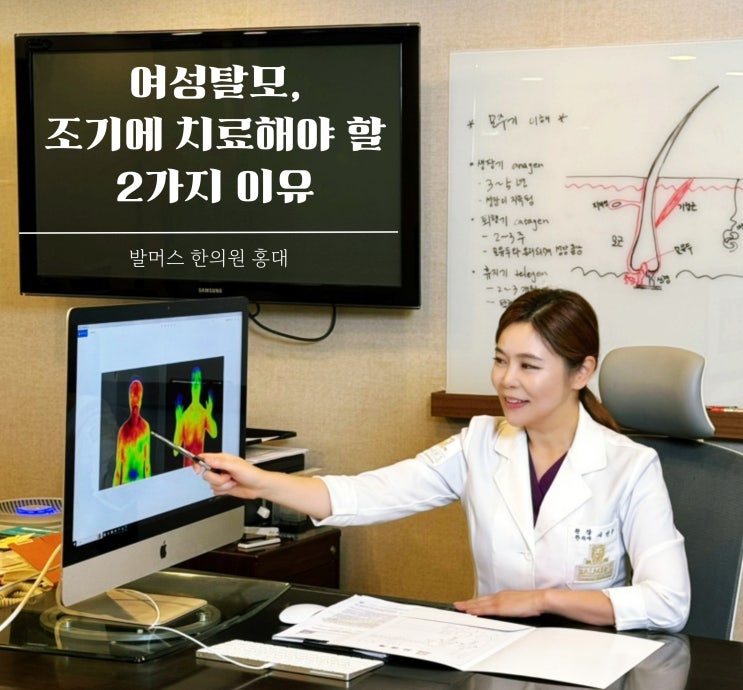  여성탈모 심해지기 전에 제대로 치료해야 하는 2가지 이유 (홍대 발머스에서 초기에 잡은 후기)