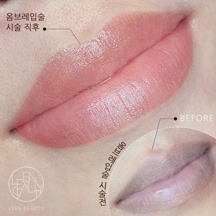  삐땅기 린뷰티, 입술문신으로 더욱 아름다워지다