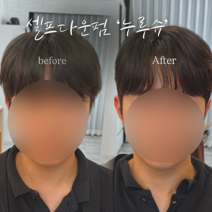  남자옆머리 셀프다운펌 기계 누루슈 : 비포애프터 후기 