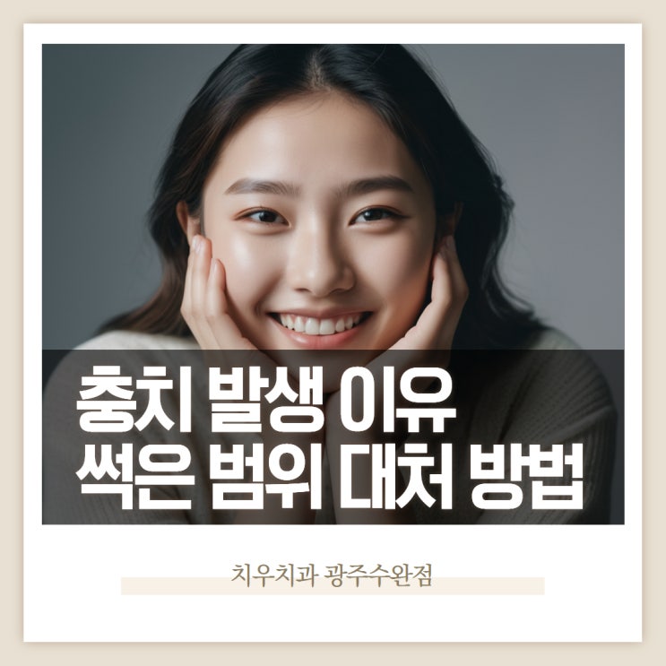 충치 발생 이유와 썩은 치아 범위에 맞는 치료법