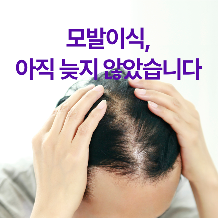  세종모발이식잘하는곳? 아직 늦지 않았습니다