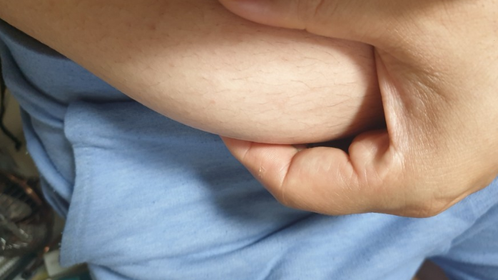  남자 여자 비만도 BMI 지수 퍼센트 계산 하기 : 기초대사량 계산기