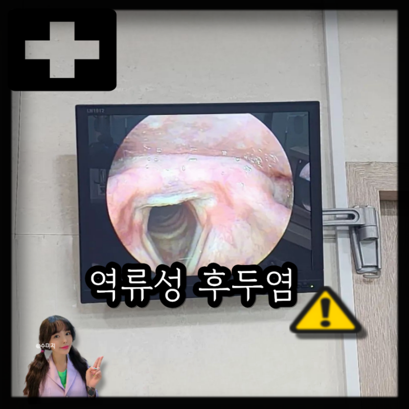 역류성 후두염 원인 증상 및 치료, 약 복용 기간은?