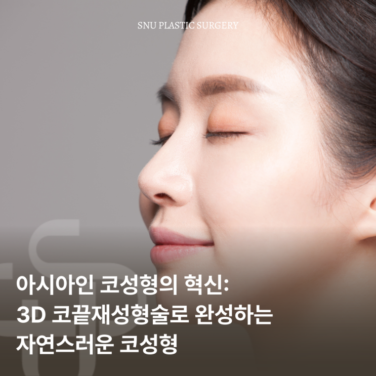  아시아인 코성형의 혁신, 3D코끝재성형술