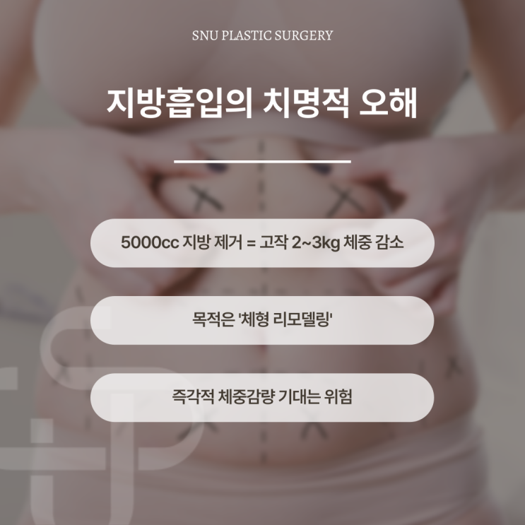  지방흡입의 오해와 진실