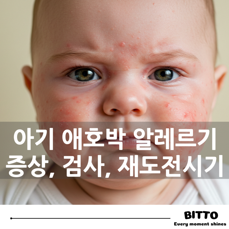 애호박 알레르기? 아기 이유식 알레르기 의심 신호와 해결법