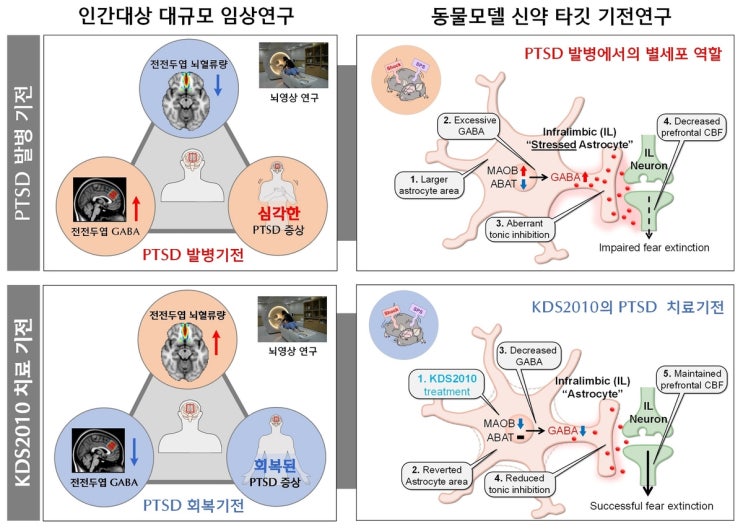  '시간이 약?' 안 통하는 PTSD…공포 기억 계속되는 이유 찾았다