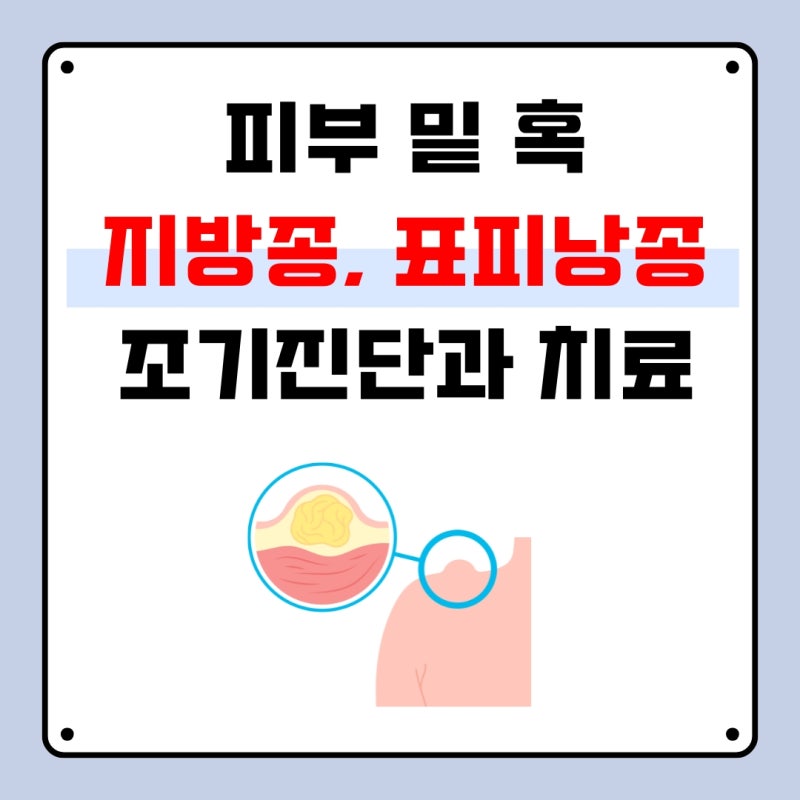 포항 지방종 표피낭종 피부 밑 혹 진단과 치료