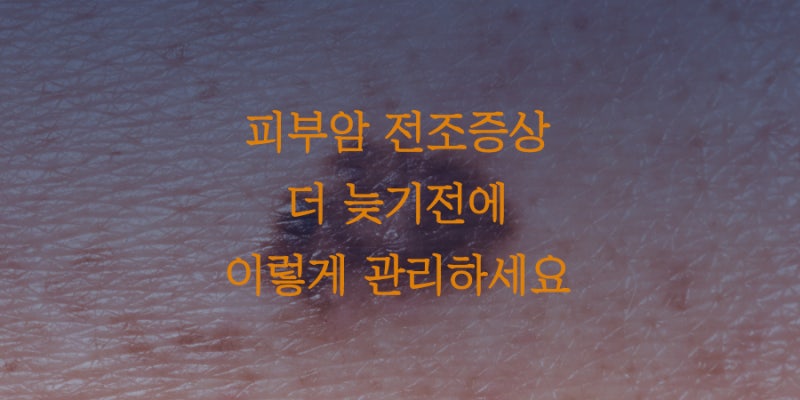 피부암 전조증상 점이 점차 커진다면
