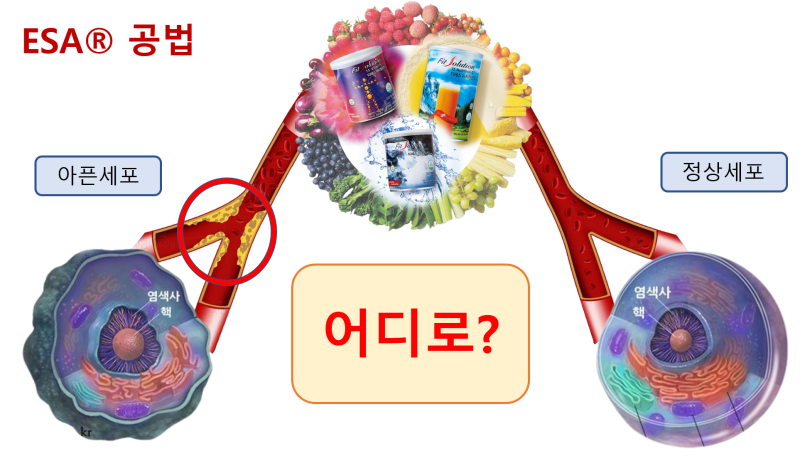 토탈스위스 공법 알아보기_ESA공법