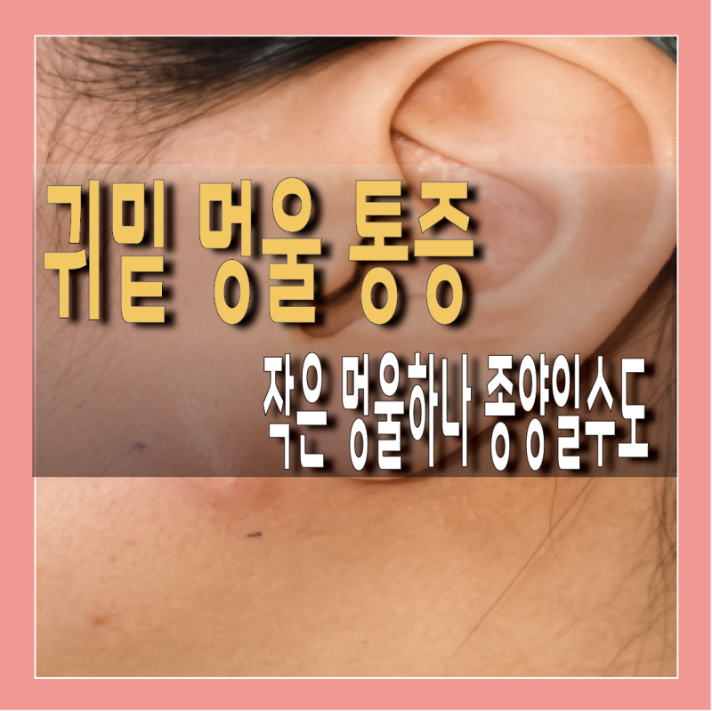 귀밑 멍울 통증 원인과 이하선 종양 진단법