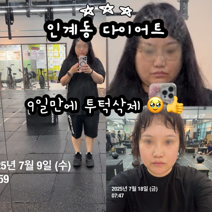  수원 인계동 다이어트 9일만에 붓기 쫙! 성공다이어트짐