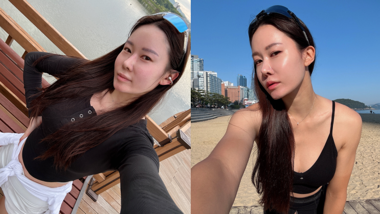 유스힐 스킨부스터 시술 후기 – 피부 속부터 차오르는 촉촉함과 탄력, 진짜 달라요!