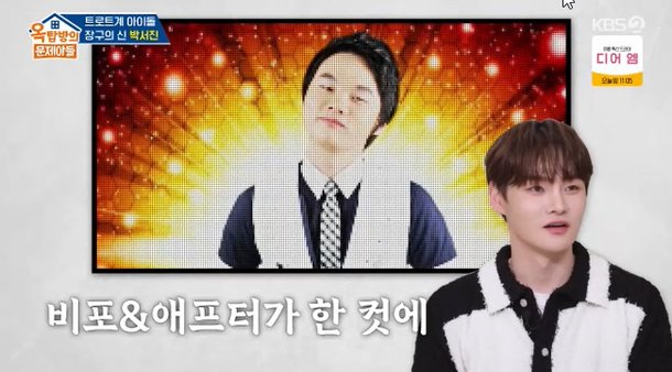 <b>박서진 성형</b> 고백 | 억대 시술 비용 공개!