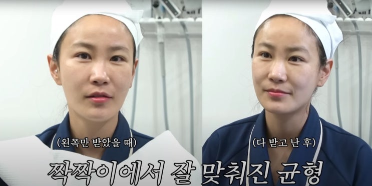<b>김지민 김준호</b> 결혼식 피부리프팅 볼뉴머 600샷 후기