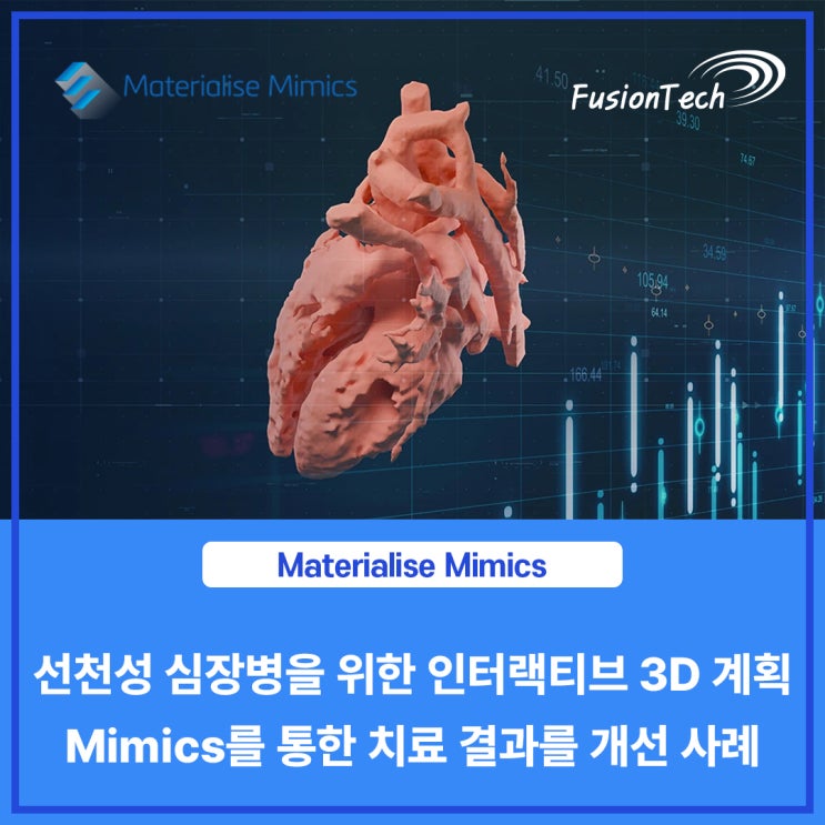  [Materialise S/W] 선천성 심장병을 위한 인터랙티브 3D 계획: Mimics를 통한 치료 결과 개선사례 - 하버드 의과대학 소아 심장과