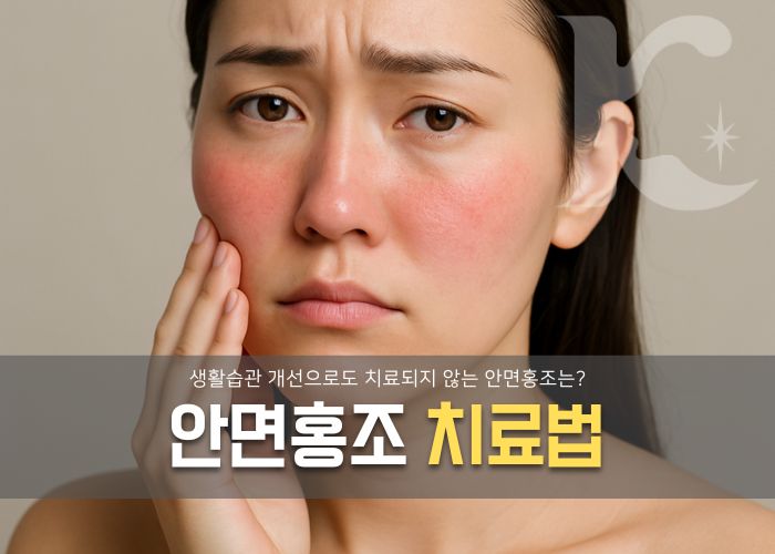  안면홍조 치료법 생활 개선으로도 안된다면