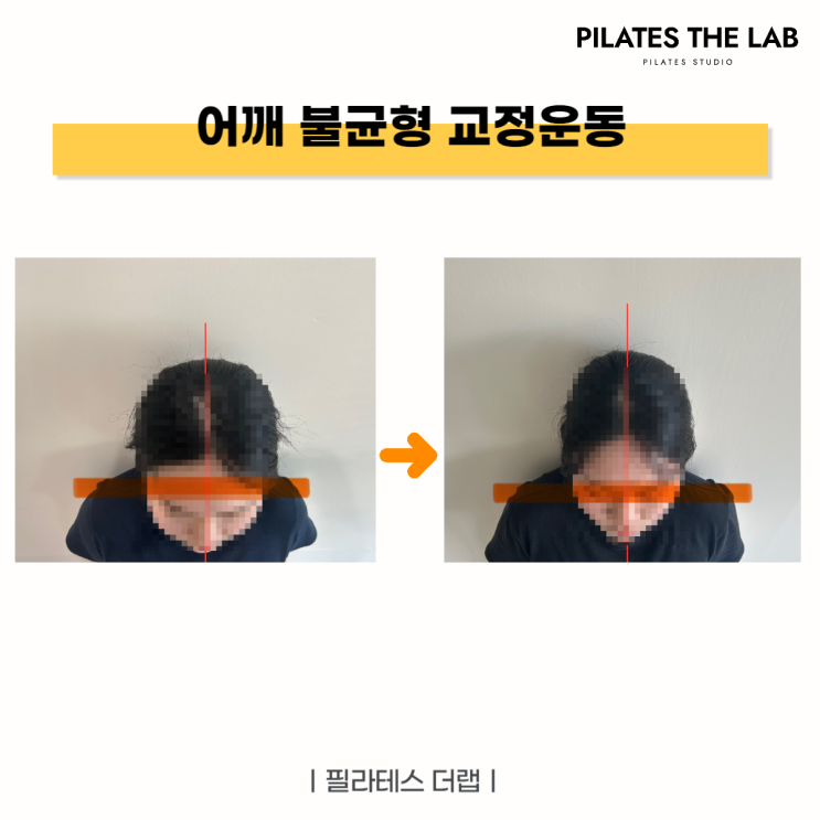  어깨 통증, 자는 자세 때문일까? 목동 필라테스에서 찾은 해결법