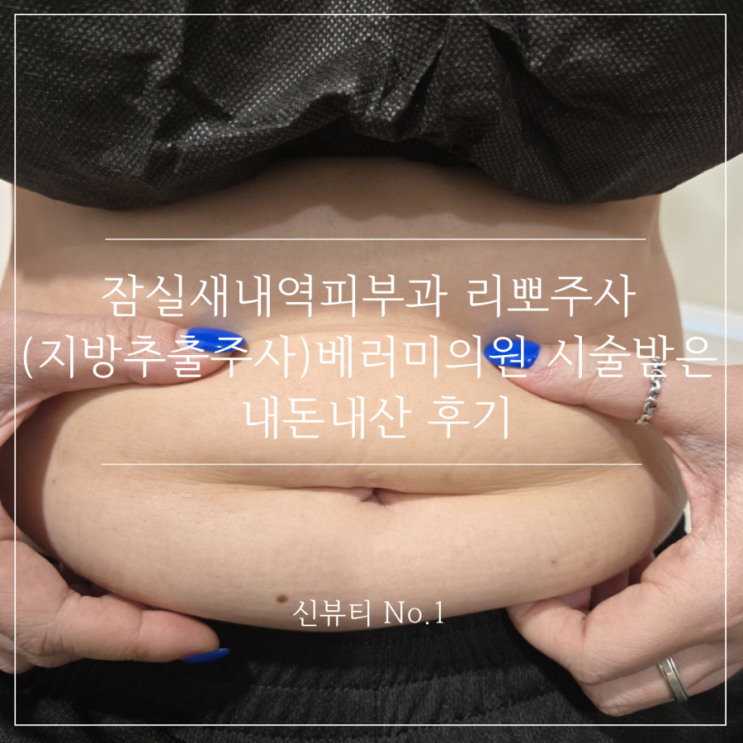  잠실새내역피부과 리뽀주사(지방추출주사)베러미의원 시술받은 내돈내산 후기