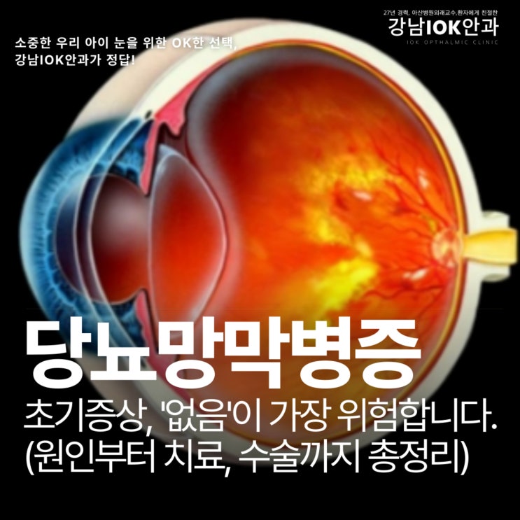  당뇨망막증 초기증상, 증상없음이 가장 위험합니다 (원인부터 치료, 수술까지 총정리)