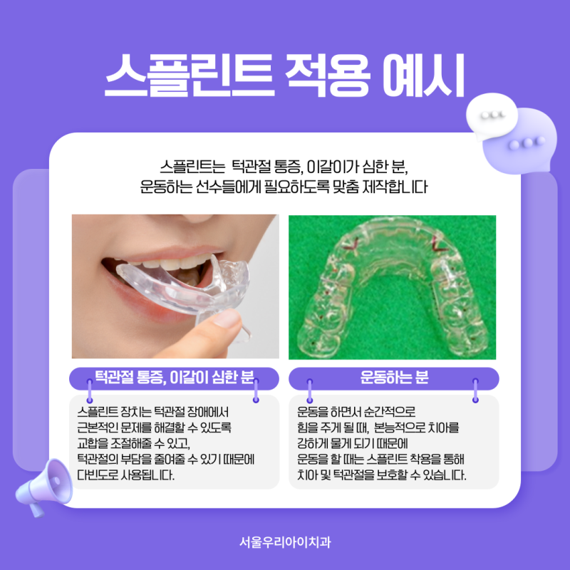 광주 구강내과 전문의가 진료하는 턱관절 통증, 스플린트 맞춤 제작