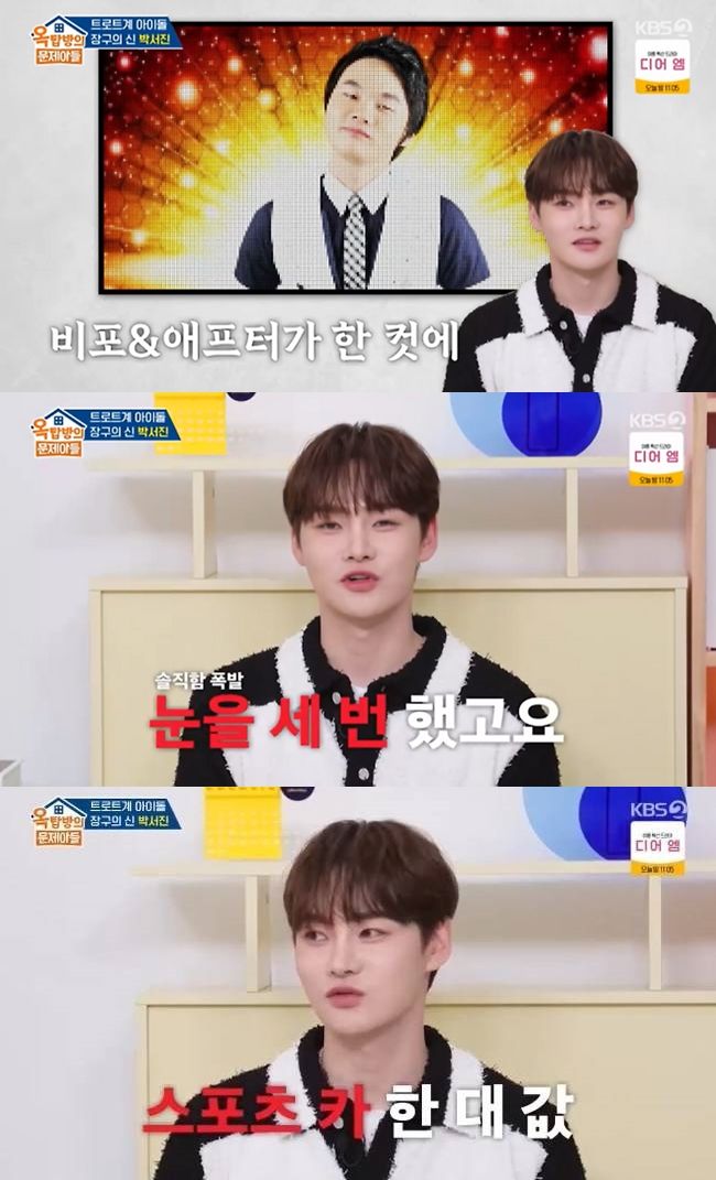 <b>박서진</b>, 억대 <b>성형</b>수술 솔직 고백…"눈·코·입 다 갈아끼웠다"