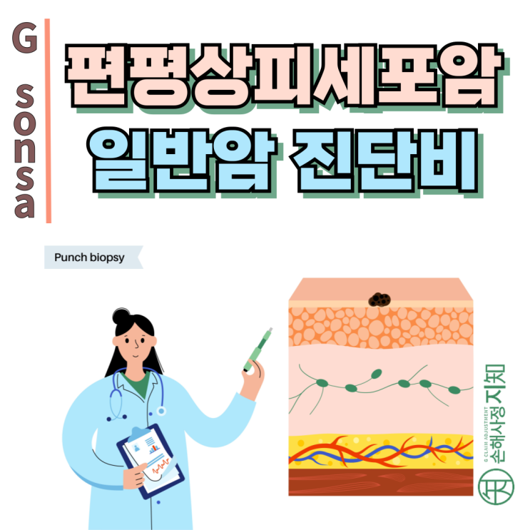  편평상피세포암 – 피부암이라도 2003년 이전 가입자는 일반암 진단비 인정 가능! - [보험금, BA+DA]