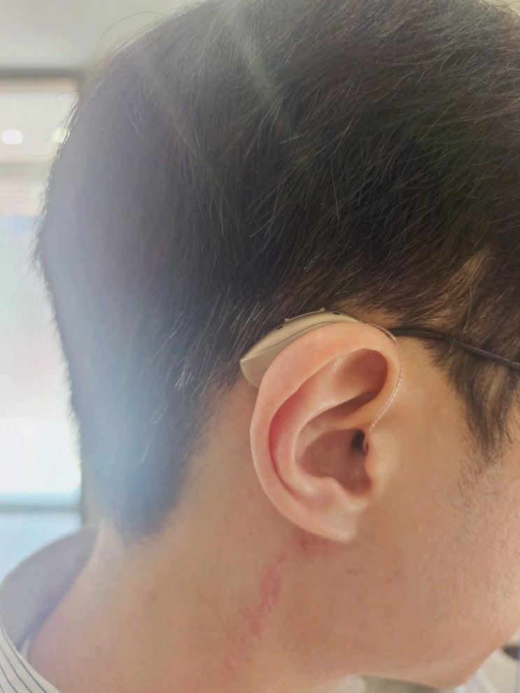  맑은소리보청기, 대전보청기로 만나는 친절한 상담과 서비스