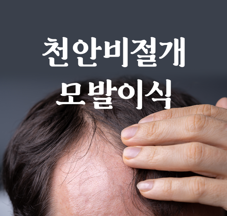  천안모발이식병원 고민 중이라면,비절개 한 길만 걸어온 모담의원을 소개합니다