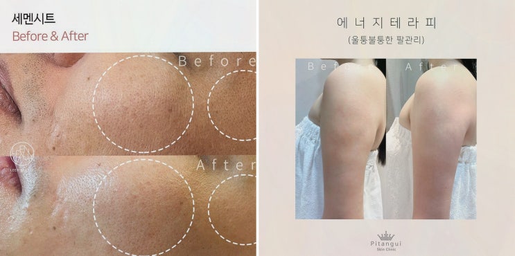  삐땅기린뷰티 센터, 체형관리로 결혼을 앞둔 신부를 도와드립니다