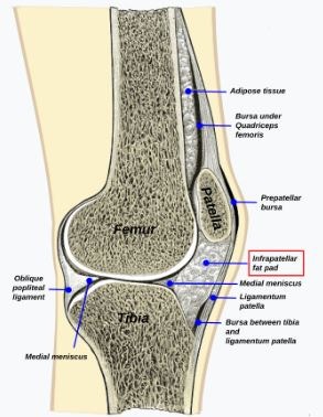 무릎 앞쪽 통증 – 덕양구 소재 드림 정형외과에서 소개하는 ‘호파 증후군’ , 지방패드 증....