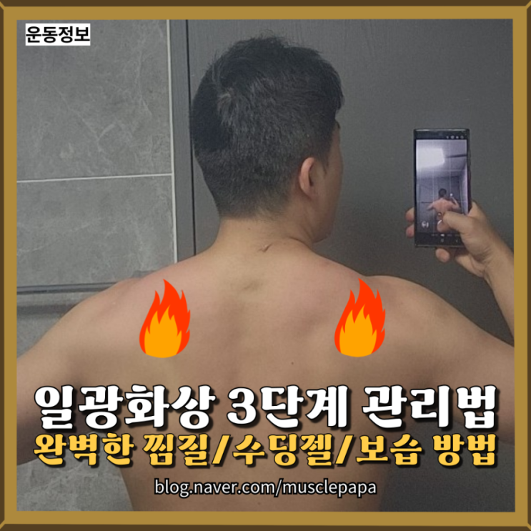  여행 후 일광화상 수딩젤로 관리하는 방법(완벽한 3step 루틴)