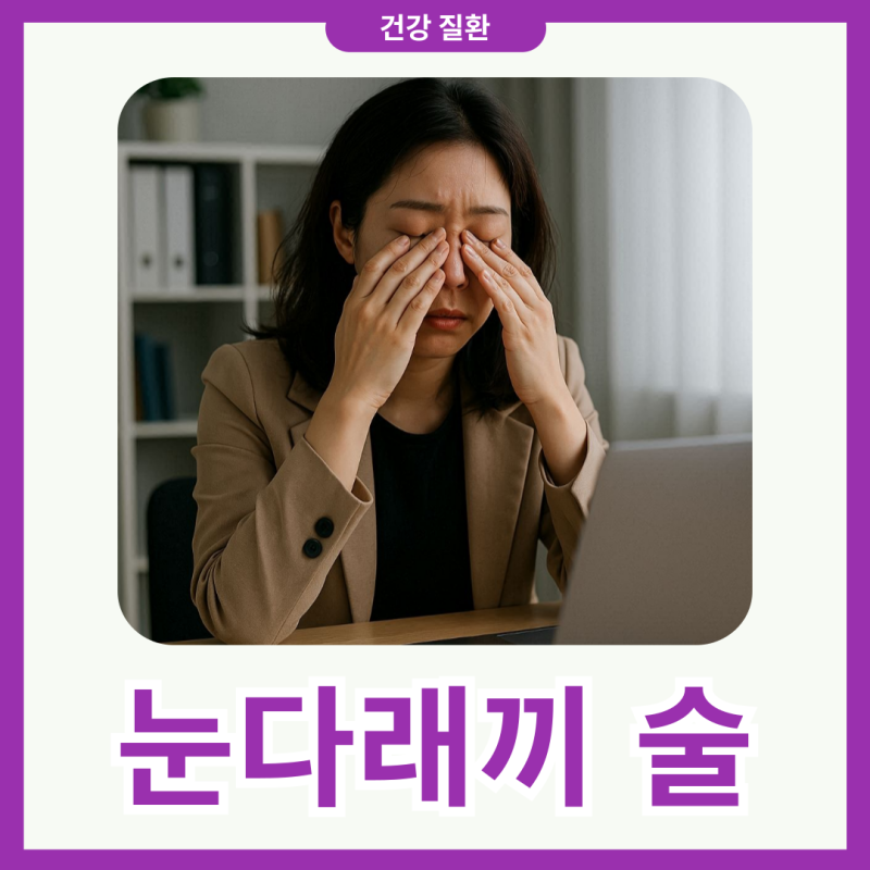 눈다래끼 술 먹으면 안될까요? 자세히 알아봐요