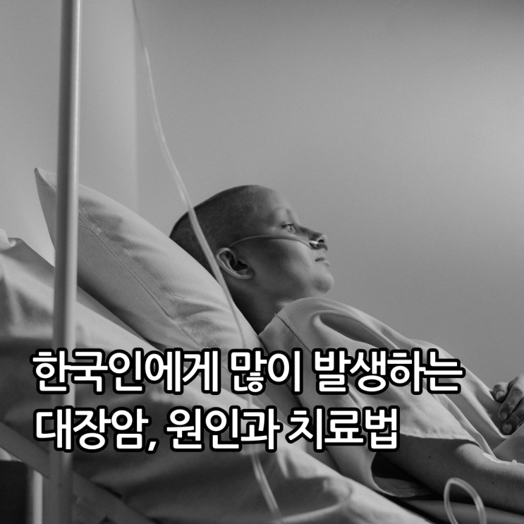  한국인에게 많이 발생하는 대장암, 원인과 치료법 알아보기