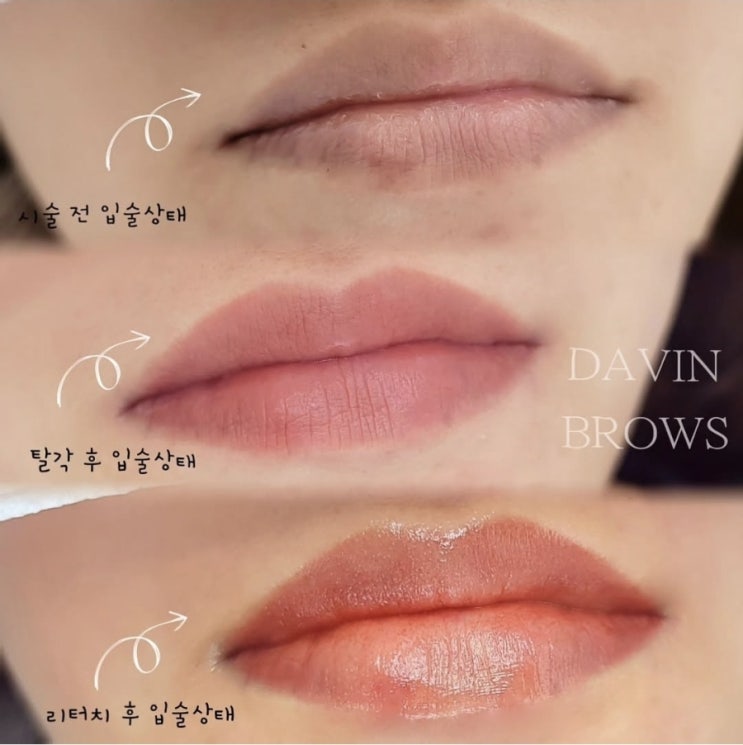  밥을 먹어도, 커피를 마셔도 생기발랄 입술그대로???!! 제주 입술문신 후기남겨요