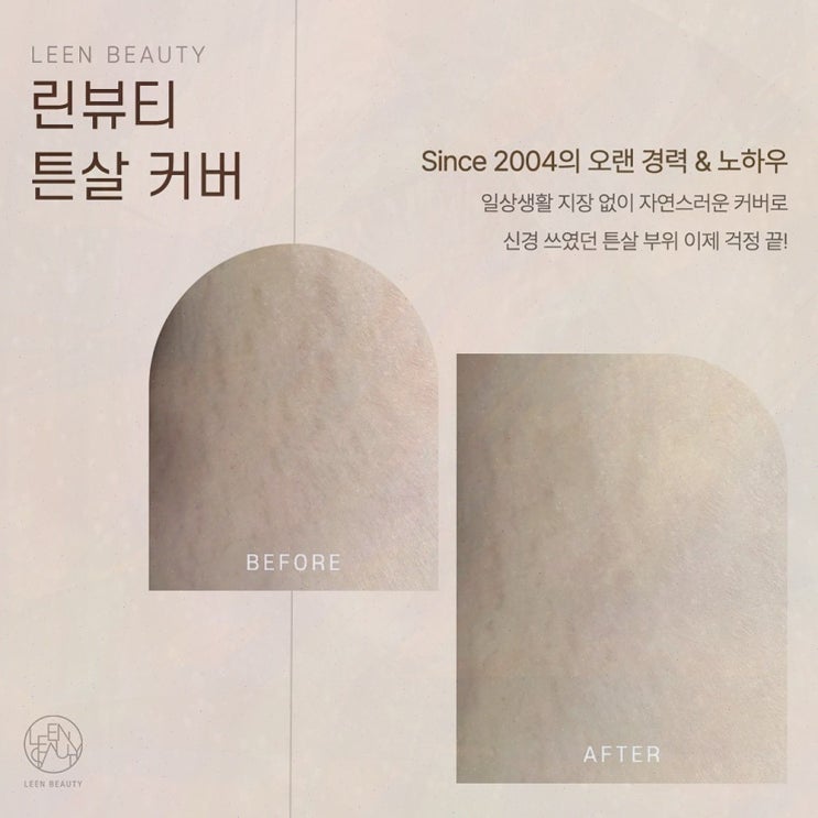  삐땅기 린뷰티, 나를 위한 아름다움과 헤어라인문신