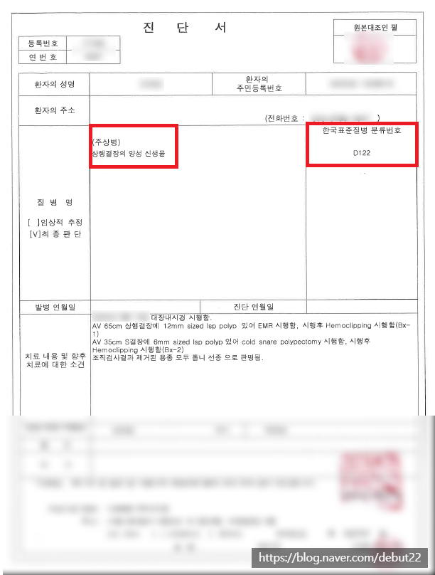 결장의 양성신생물 D122 제자리암 진단비 가능